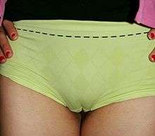 Color photograph of a camel toe